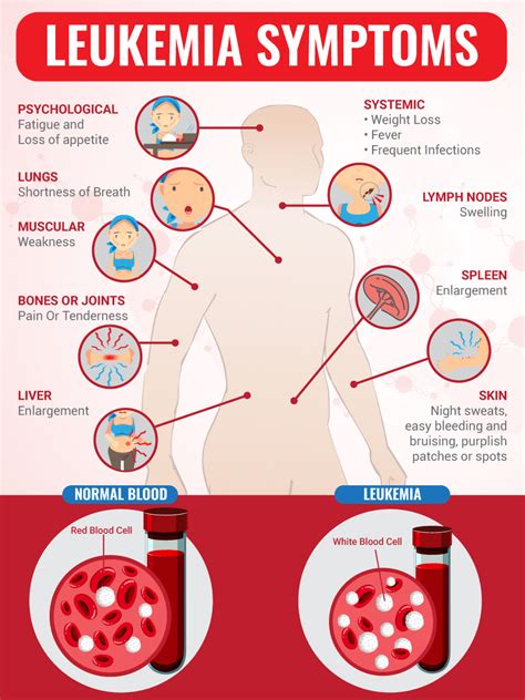 leukemia symptoms women over 50.